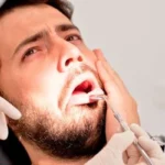 Alveolitis seca: Dolor intenso después de sacar una muela