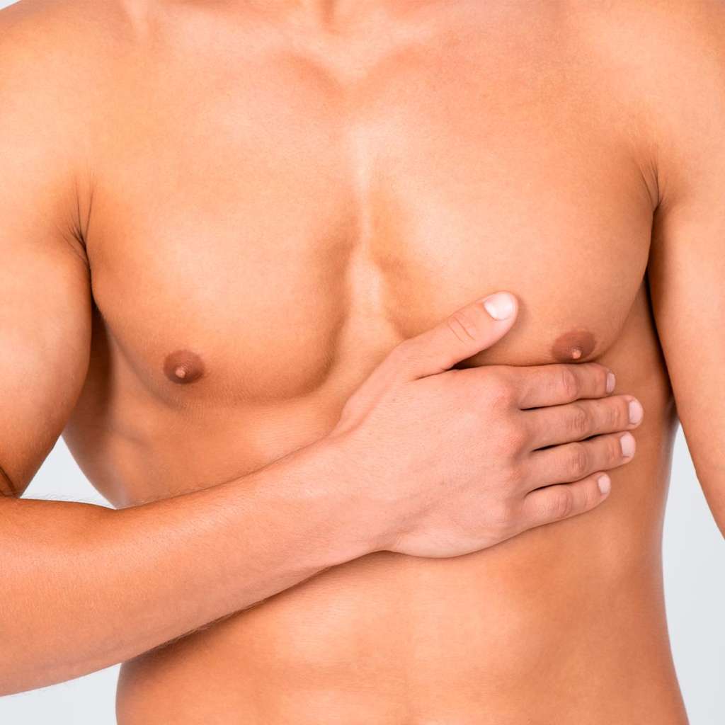 Ginecomastia en hombres sin cirugía: ¿Es posible?