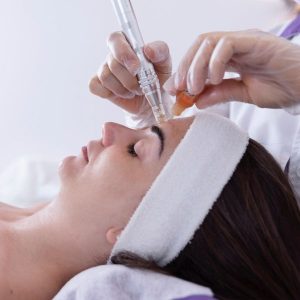 Lifting de Vampiro (PRP Facial): Beneficios reales