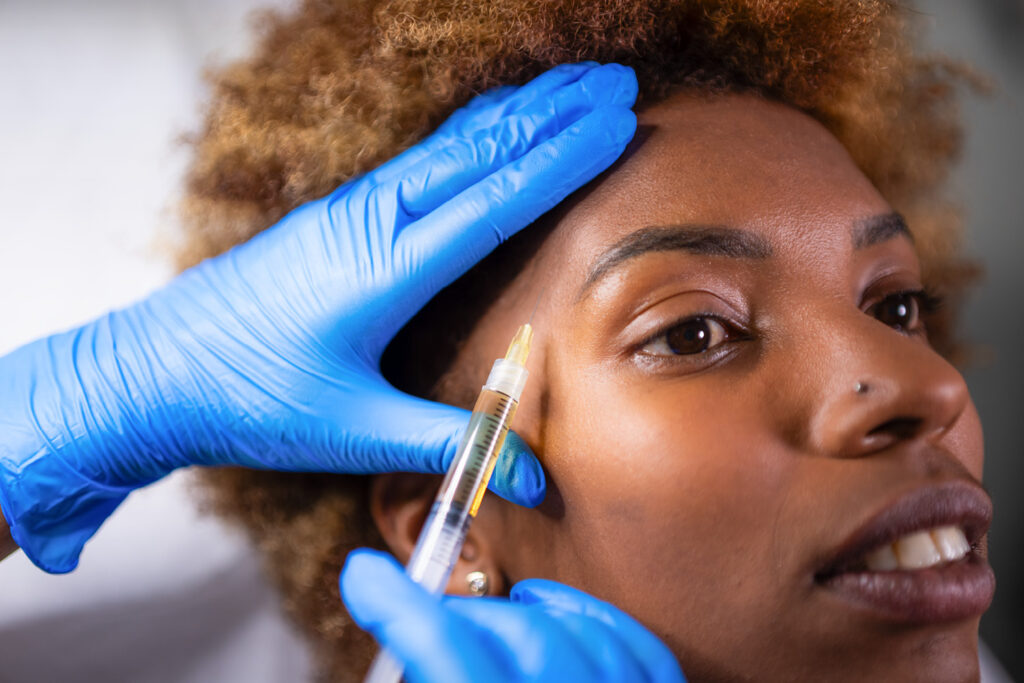 Lifting de Vampiro (PRP Facial): Beneficios reales