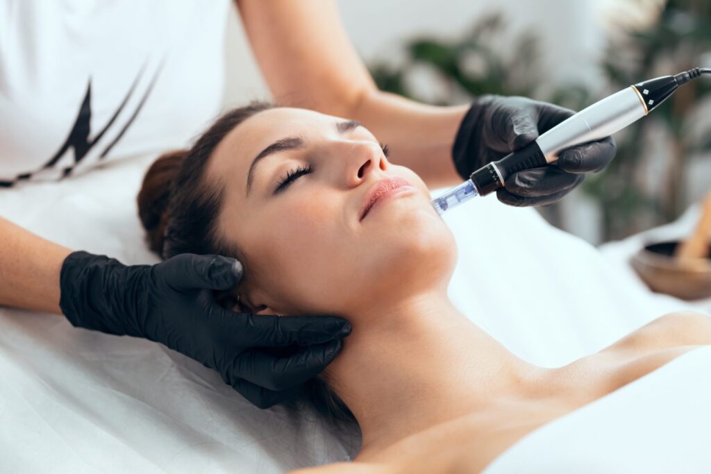 Lifting de Vampiro (PRP Facial): Beneficios reales