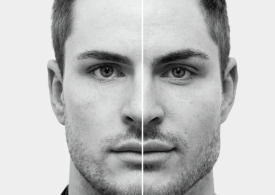 Masculinización facial: Definir mandíbula y mentón en hombres