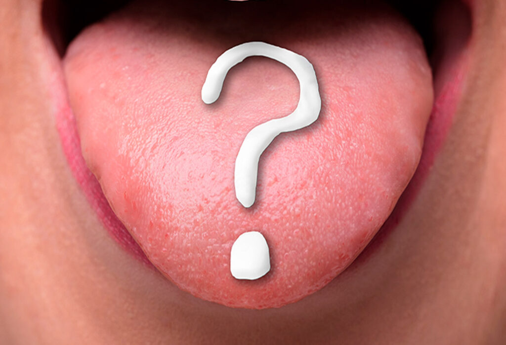 Parestesia dental: Hormigueo en el labio tras el dentista