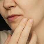 Queilitis angular (Boqueras): Causas y tratamiento rápido