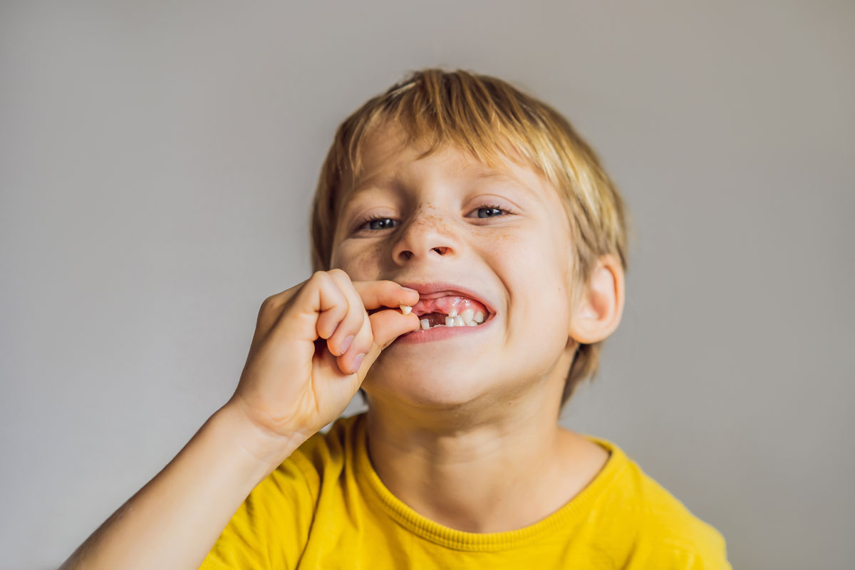 Diente avulsionado: Qué hacer si se te cae un diente por un golpe