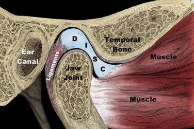 Dolor de mandíbula y oído: ¿Es culpa de las muelas o del estrés?
