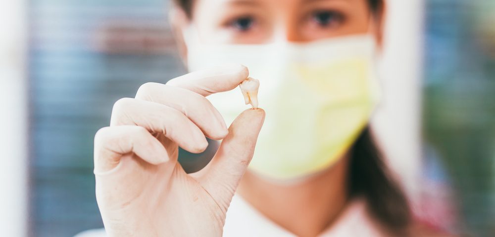 Alveolitis seca: Dolor intenso después de sacar una muela