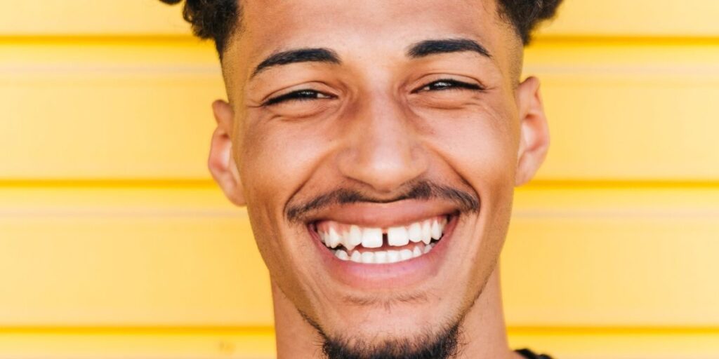 frenillo labial superior